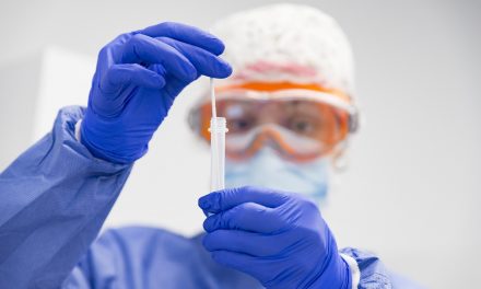 İl Dışından Gelen PCR Testi Tanı Laboratuvarları’na Dikkat